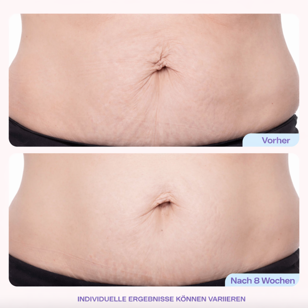 Pure |  BellyCream™