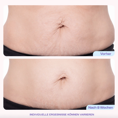 Pure |  BellyCream™